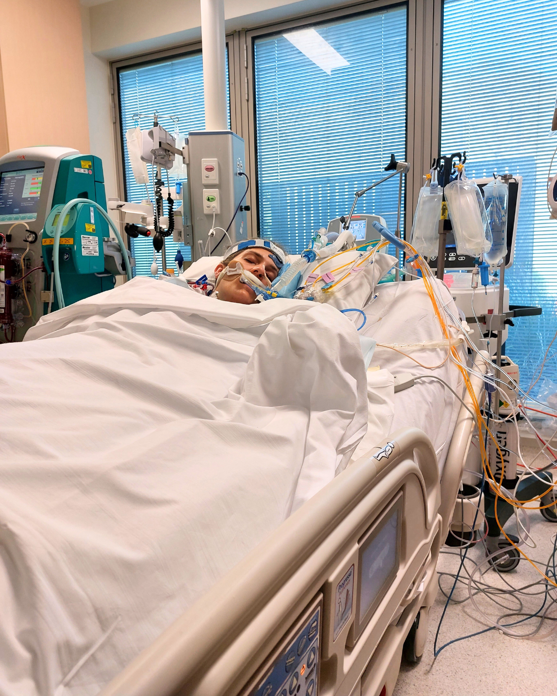 Patient Kylie Dibb laying in a hospital bed in the ICU.