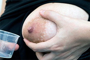 A woman holds her left breast in her left hand to collect drips of colostrum from her nipple