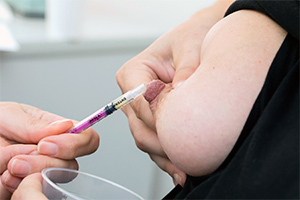 A woman holds her right breast in her right hand and holds a syringe in her other hand to collect drips of colostrum from her nipple